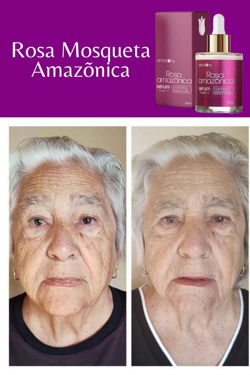 Rosa Amazônica Rejuvenescedor + Brinde